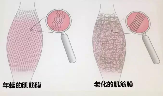 筋膜放松要看整体