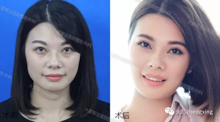 对比