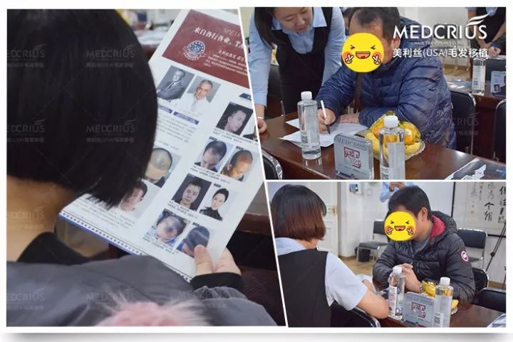 治脱发擦生姜?当心用错变秃头!脱发、秃顶、前