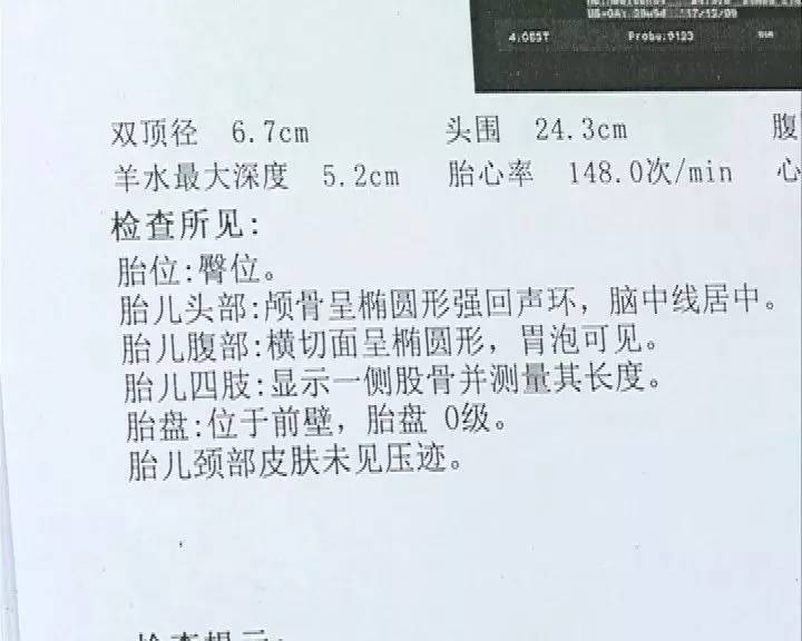 【悲剧】二胎妈妈为保胎历尽艰辛,住院半年打了几百针
