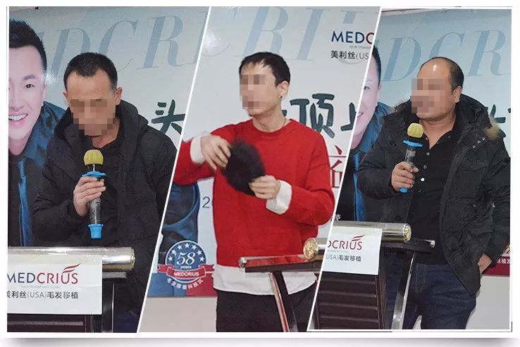 治脱发,你还在擦生姜吗?当心变秃头!脱发、秃