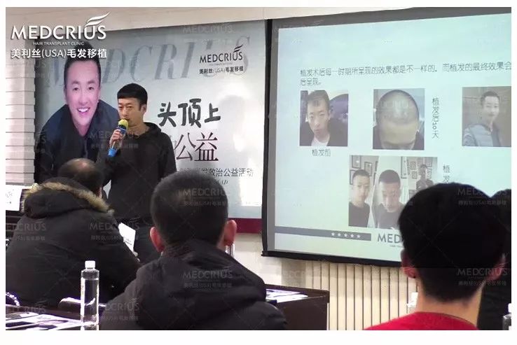 治脱发,你还在擦生姜吗?当心变秃头!脱发、秃