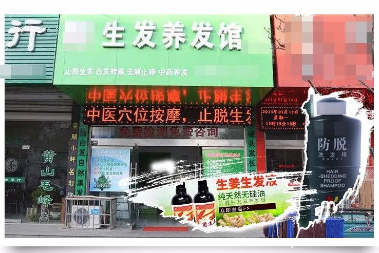 治脱发,你还在擦生姜吗?当心变秃头!脱发、秃