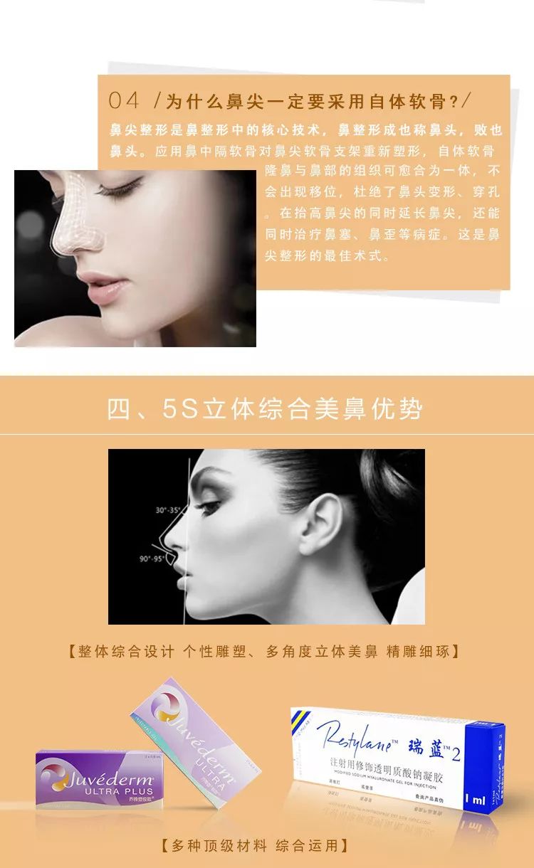 优势