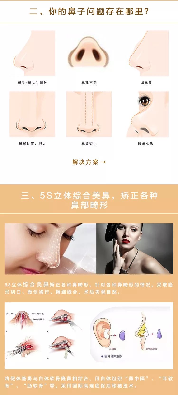 鼻子