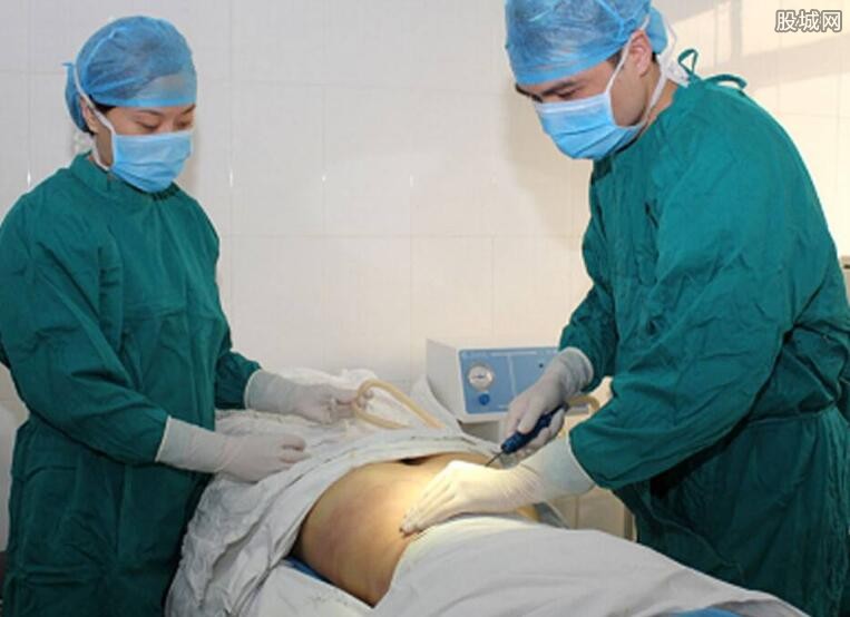 大腿抽脂多少钱?大腿抽脂价格贵吗?