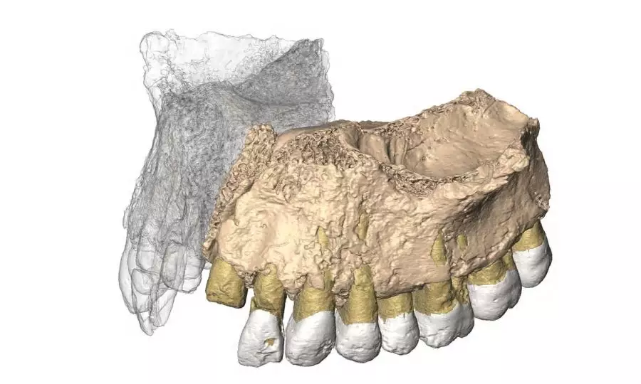 上颌骨碎片与缺失部分的复原图。来源：赫斯科维兹教授