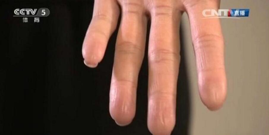 孙杨指纹消失 荣耀V10为其开发智能人脸解锁