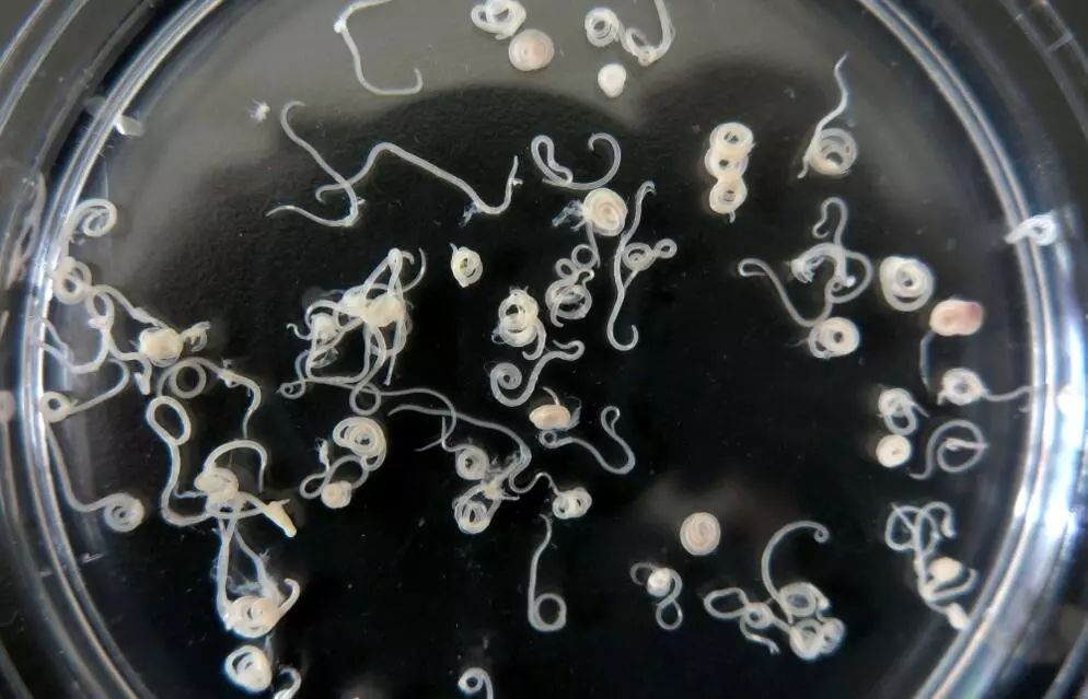 青岛人常吃的21种海鱼中,竟然都检测出有这种