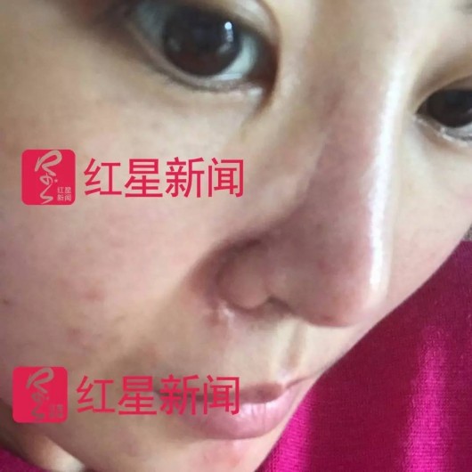 被打女子小董的近照受访者供图