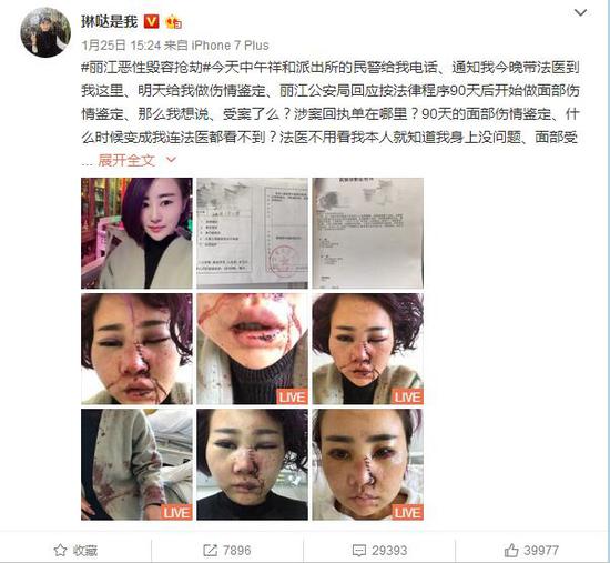 丽江被打女游客发布微博