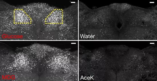 喝糖水或MDG溶液后，小鼠cNST明显兴奋