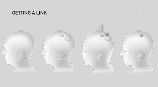马斯克震撼发布脑机接口 Neuralink无损植入猪脑 下一步植入人脑