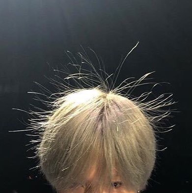 袁咏仪和杨超越最近有同样的困扰 头发静电怎