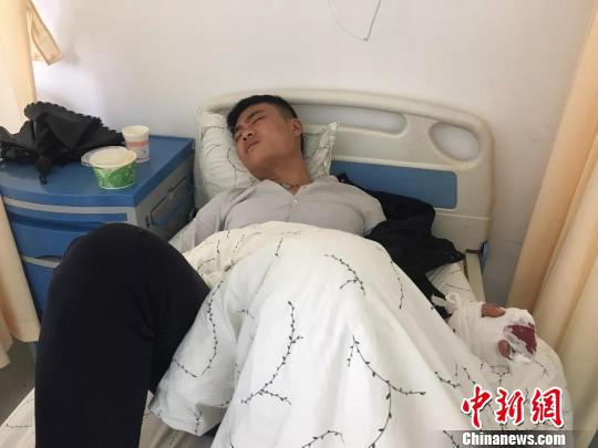 图为进行修复手术前的刘鑫。云南骨科医院供图