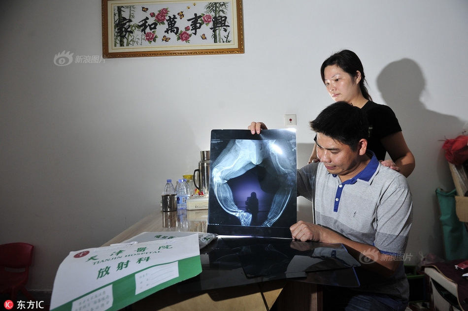 A级毛片免费看