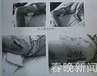 记者 龙宇丹 摄