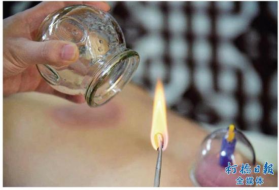 绍兴市中心医院等各大医院艾灸和三伏贴火爆