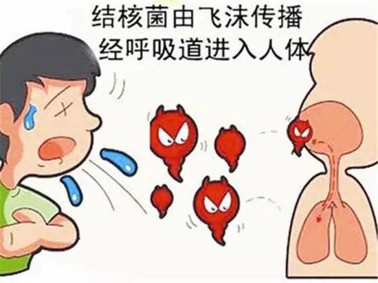 网络图片,结核病菌的常见传播方式