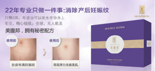 肥胖纹能去掉吗?选择最好的去肥胖纹产品让你没有后顾之忧。