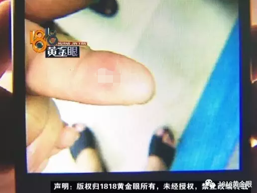 汪先生:“电了呀,早几天肯定是有漏电,他们没有处理好。”