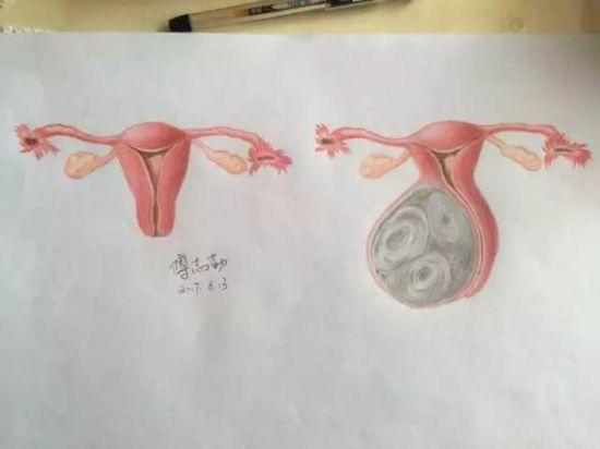 杭州美女医生的医学插画走红 肤白貌美还是学霸(图)_新浪浙江_新浪网