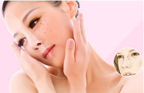 祛斑产品会反弹吗?揭晓口碑最好的祛斑产品