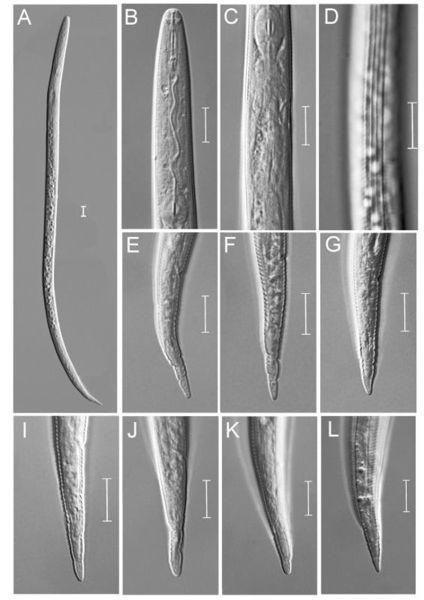 图为根结线虫属(Meloidogyne sp.)新种 宁波海关供图