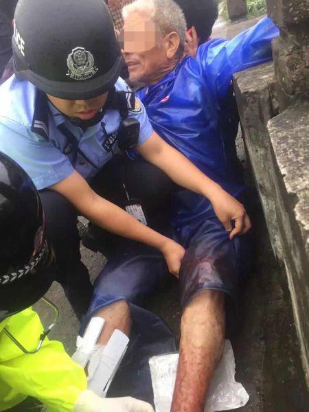 图为:老人双腿受伤严重。苍南警方提供