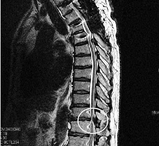 胸人口处痛_脖子淋巴处有点痛(3)