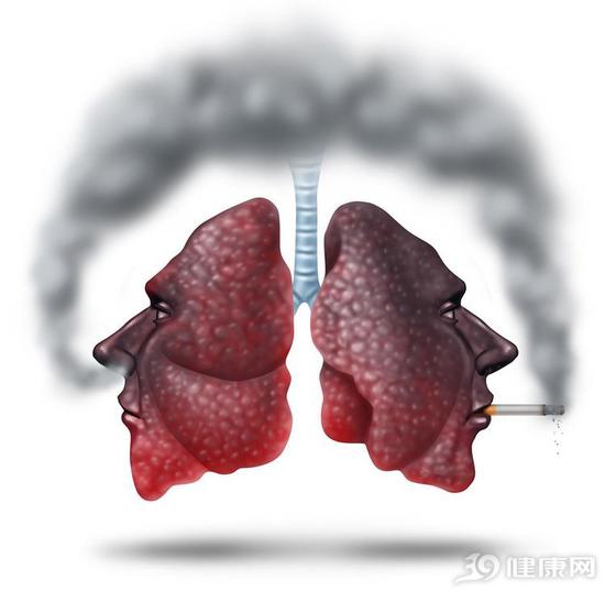 老烟枪出现这些症状,说明肺部有毛病
