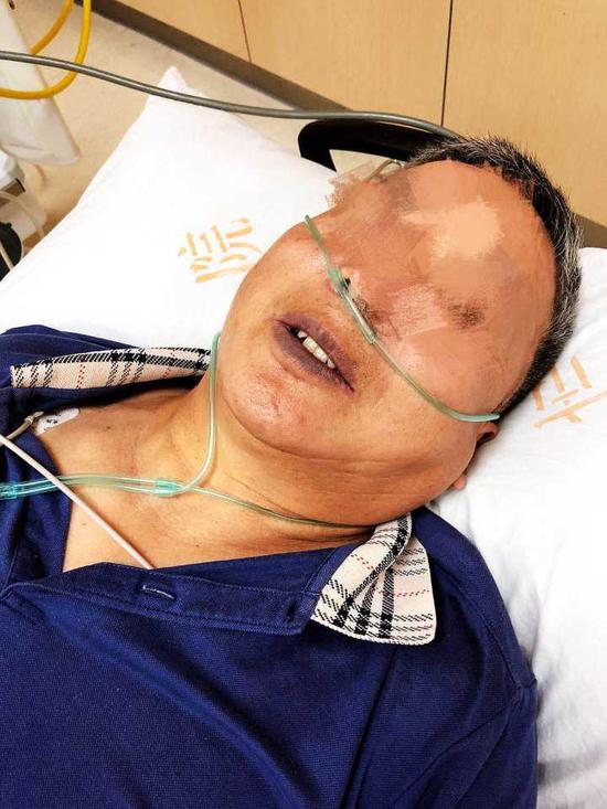 杭州大伯吃一整碗腌苋菜梗 嘴唇和指甲开始发紫