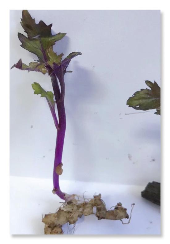 引起谢大爷肝硬化的原因究竟是什么呢?