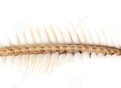 金华68岁阿姨反复咳嗽3个月 一根鱼骨卡在气管