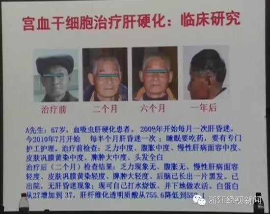 1研究中心呼吁捐献大姨妈 通过经血来采集干细胞