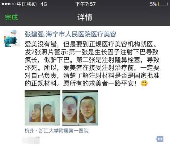 嘉兴1女子美容院打玻尿酸隆鼻 误打进血管致鼻