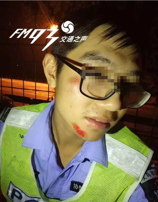 义乌1男子撞伤交警扔下妻子跑路 致交警脸颈手