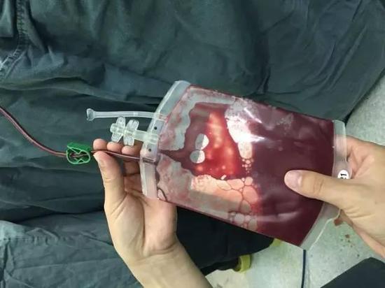 嘉兴41岁母亲为救白血病儿子 再生二孩储存脐带血