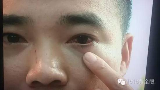 杭州女子深夜酒吧门口遇裸男 代驾司机却遭到