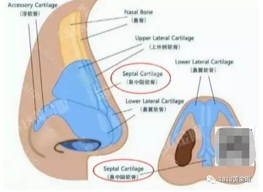 杭州1美女整容后鼻子成C型 医院:本来就是歪的