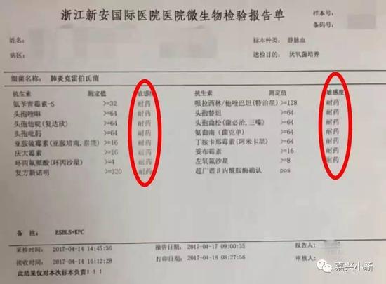 嘉兴男子感染超级细菌 全球30%患者因此丧生