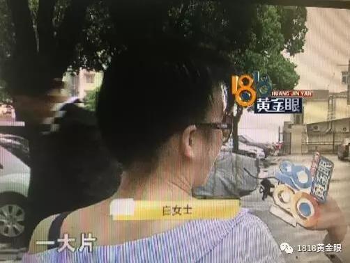 宁波一女子隆胸觉得胸下垂 责难医院没整好