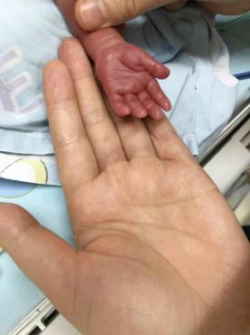 800克"袖珍宝宝"出院了