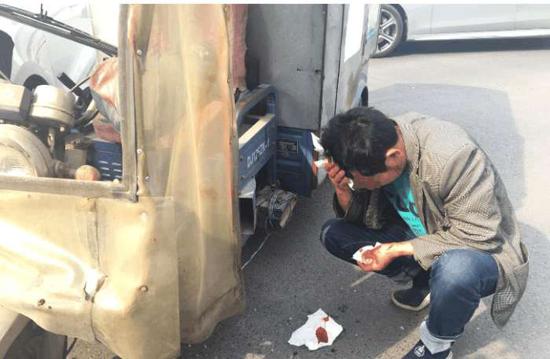 三轮车司机头部出血。