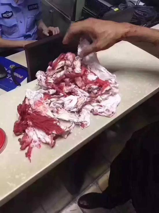 瓜子二手车与车商纠纷引冲突 打致对方头破血流