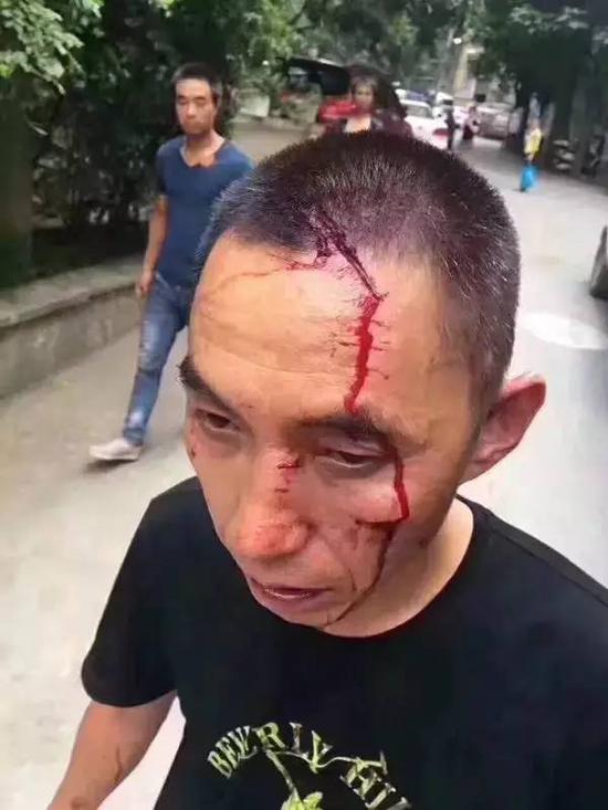 瓜子二手车与车商纠纷引冲突 打致对方头破血流