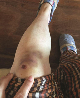 女子被摩托男踹倒续：行凶者已多次作案