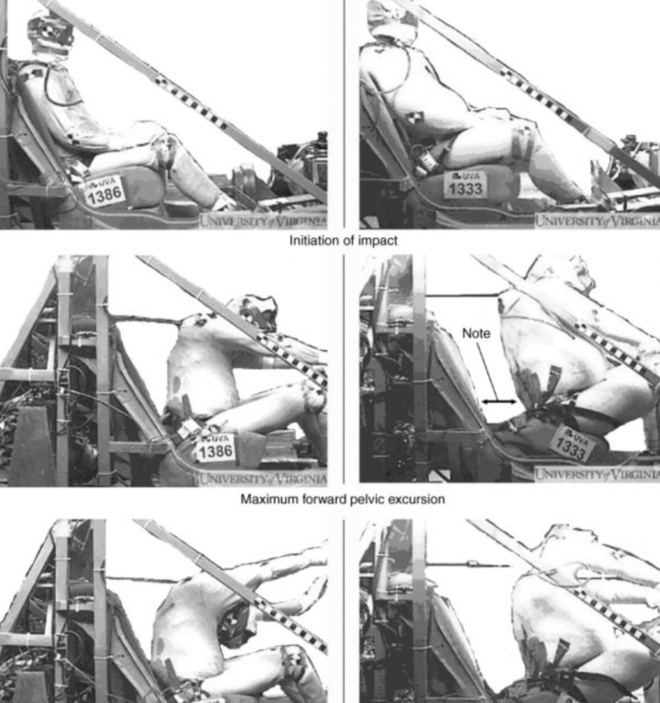 警钟：吃得越胖车祸死亡率越高？