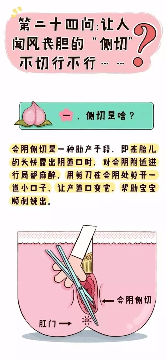 让人闻风丧胆的"侧切",不切行不行?