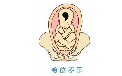 怀孕七个月正常胎位图图片